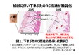 加齢で目立つ“目袋”に繋がる「下まぶたの構造変化」を解明