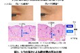 シワが刻まれにくい“しなやかな真皮”に修復する鍵を発見