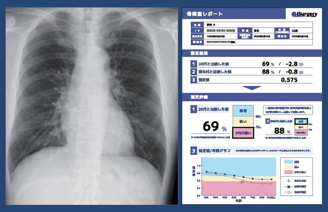 AI医療機器による分析検査