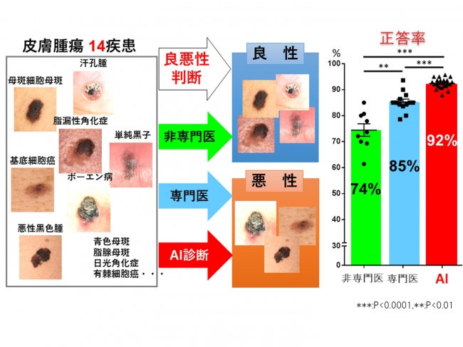 本研究で開発したAI診断補助システムと日本皮膚科学会認定皮膚科専門医の皮膚腫瘍の良悪性識別率 比較