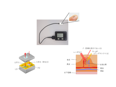 国立大学法人九州大学・Palmens株式会社との「MEMSマイクロ血流量センサ」製品化に向けた共同開発のお知らせ