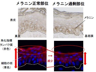 メラニンが過剰発生した部位のターンオーバー方向の乱れと、肌老化の関係に着目。「緑茶カテキン」に表皮細胞分裂を垂直に導く機能を発見