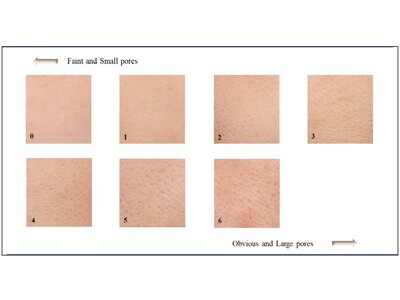 高濃度ビタミンC誘導体とノイバラ果実エキスの併用によるヒトの肌への効果をハーバー研究所が検証