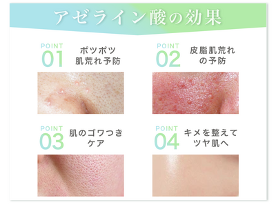 【4/7（火）再販開始】先行販売後３日で完売した、敏感肌のための新アゼライン酸美容液が再入荷。春夏の肌荒...