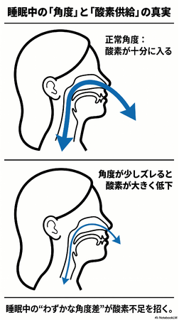 「医学の死角。血糖値・中性脂肪は“睡眠中の酸素不足”では下がらない。・・・解決策（新発見）」