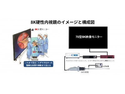 “世界初”70型8K映像モニターを医療分野に展開8K硬性内視鏡システムへ活用