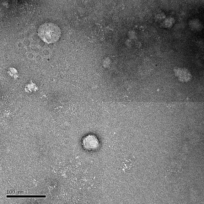 発酵から生まれた植物性発酵物由来エクソソーム様構造体の含有を発見!!