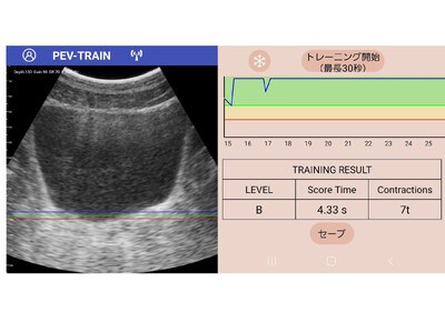 スマホで自分の骨盤底を見ながら「骨盤底トレーニング」ができるスマホ・エコー連動型アプリ『PEV・TRAIN -ぺブトレ』開発完了。