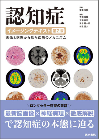 認知症の本態に迫る！書籍『認知症イメージングテキスト　第2版　―画像と病理から見た疾患のメカニズム』5/4発売