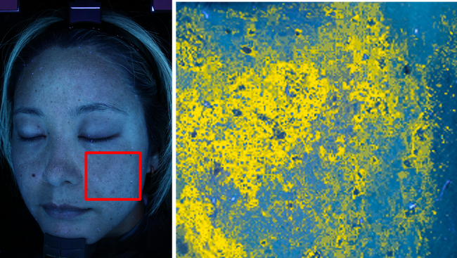 にんじんジュースを継続摂取した結果、7人中6人の隠れジミが平均13.4%改善傾向に「β-カロテン継続摂取による隠れジミ対策」モニター調査※1結果を公開
