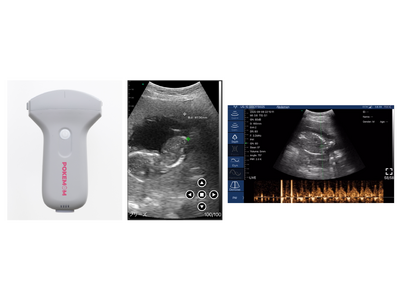 �X�}�z�p�����g�G�R�[�̍������Y�J�n�ƓƐ�_������̂��m�点