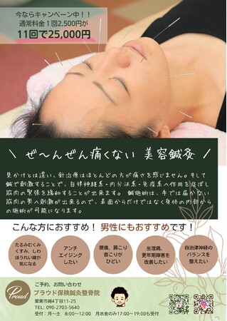 おすすめ！美容鍼灸やってます！！