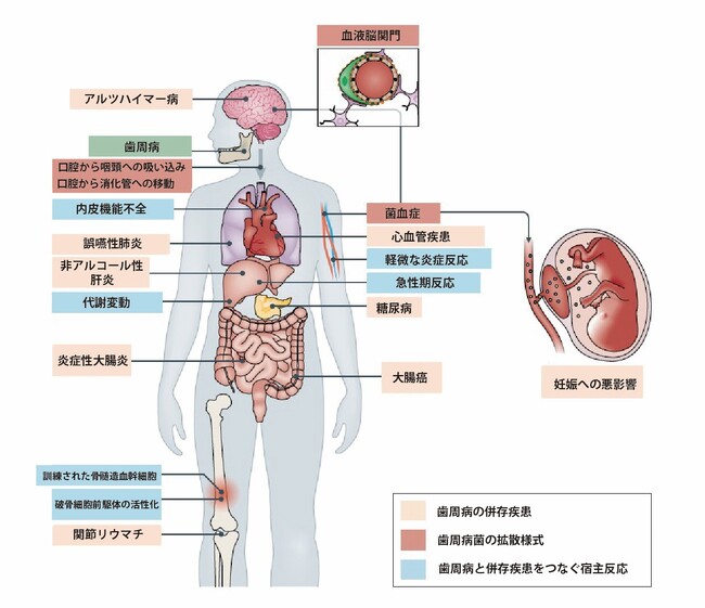 大阪大学 天野先生監修『歯垢リスクチェックシート』を公開　約2人に1人が「歯垢リスク」を抱えることが判明