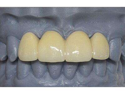 �ߘa8�N�x�f�Õ�V������󂯂Ė₢���킹���}���@�f�W�^�����{�E��X�Z�H����Canon�Ђ̃~�����O�}�V���uMD-500S�v�𑝐ݓ���