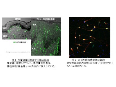 高精度のヒトｉＰＳ由来感覚神経細胞の作成に成功　順天堂大学「抗加齢皮膚医学研究講座」の研究に応用