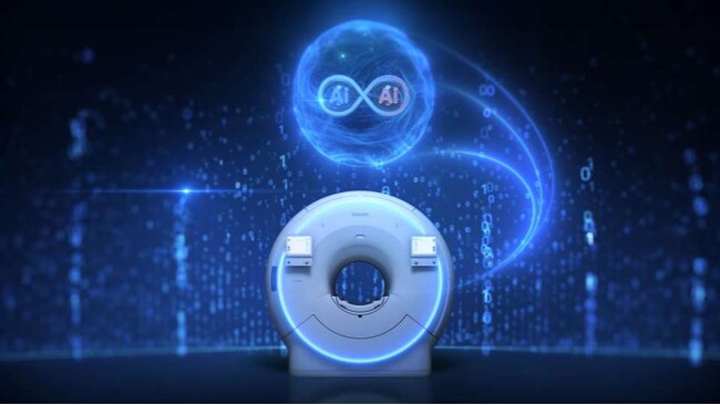 AI技術によりMRIのさらなる高速化と高画質化を革新　「SmartSpeed Precise」登場