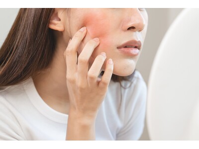 ■【2026年度｜10～50代男女1000名へ聞く！性別・世代別に「肌悩み」を調査分析】男女ともに1位は「毛穴の悩み」（女性：51.4%／男性：34.0%）