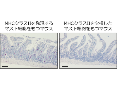 食物アレルギー症状の悪化に関わる新規メカニズムの解明