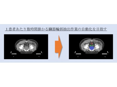 Ristが京都大学医学研究科とCT医用画像へのAIを用いた業務自動化に関わる共同研究を開始