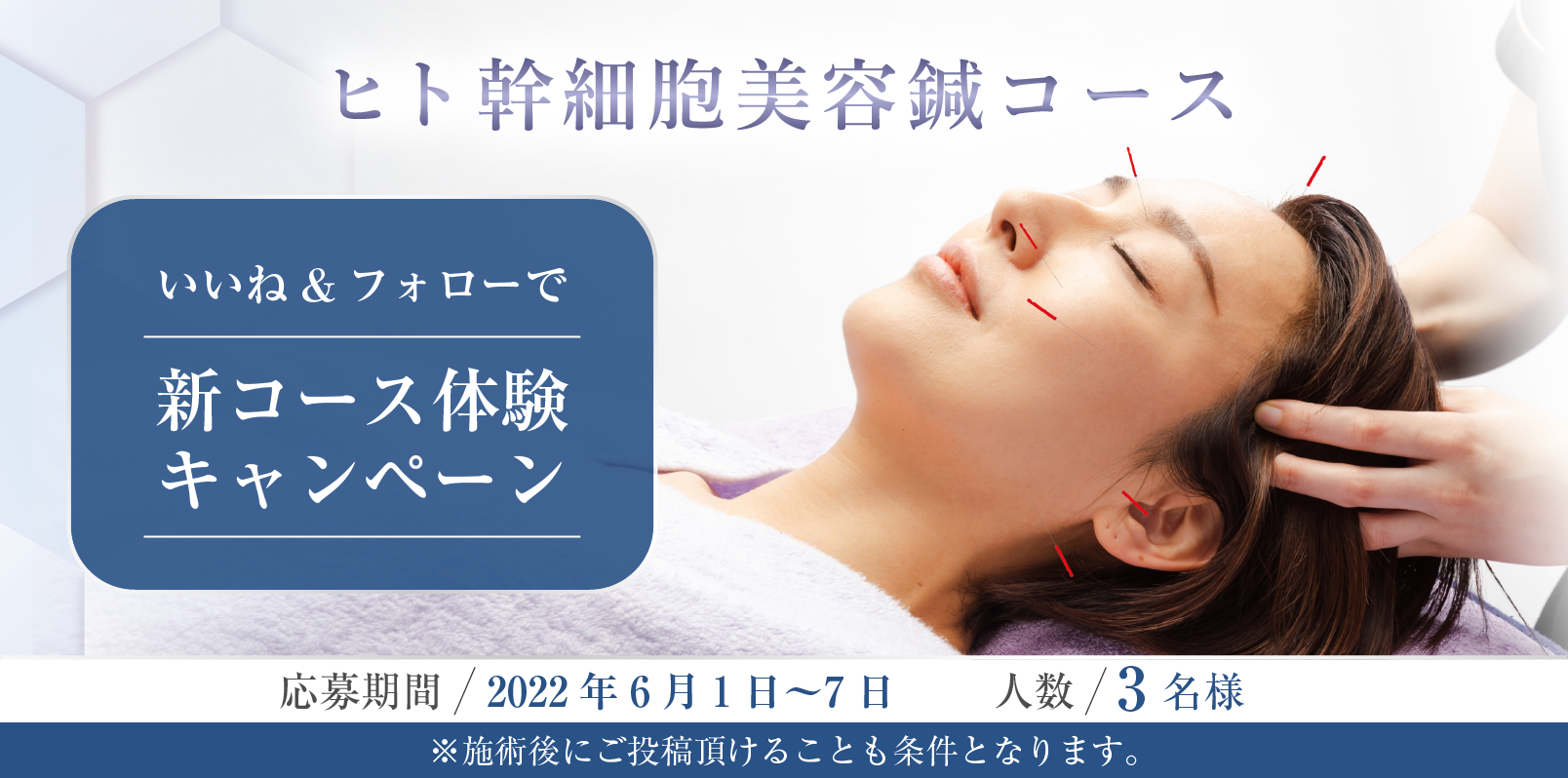美容鍼サロン「C by CALISTA」からヒト幹細胞美容鍼コース発売記念　「いいね＆フォローで新コース体験キャンペーン」を開催