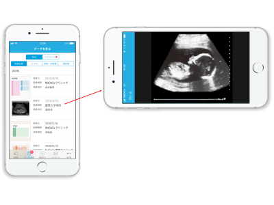 MeDaCa、赤ちゃんの超音波画像をデジタルで提供開始