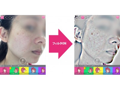 あなたのお肌にも、あるかも…！ 隠れ肌トラブルが見えるアプリ「肌あれ予報」3/25リリース！