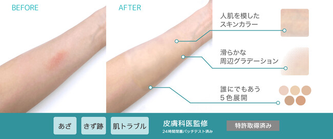 気になるきず跡や肌トラブルをもっと自然にカバー！究極の肌なじみを追求した肌用カバーシール「彩肌ベール」が新登場