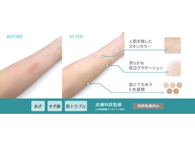 気になるきず跡や肌トラブルをもっと自然にカバー！究極の肌なじみを追求した肌用カバーシール「彩肌ベール」が新登場