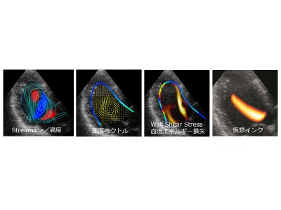 流体力学による心臓エコー画像解析ソフト「Echo Flow Dynamics」の提供開始 企業リリース | 日刊工業新聞 電子版