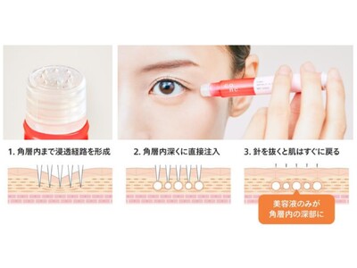 発売3カ月で年度販売目標数※1を達成！「CONC リンクル インジェクション」が好調