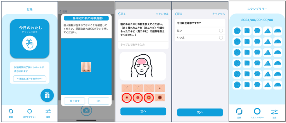 大人ニキビの発症に関わる生活習慣を明らかにするため、スマートフォンアプリを活用した調査を開始