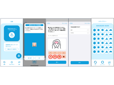 大人ニキビの発症に関わる生活習慣を明らかにするため、スマートフォンアプリを活用した調査を開始