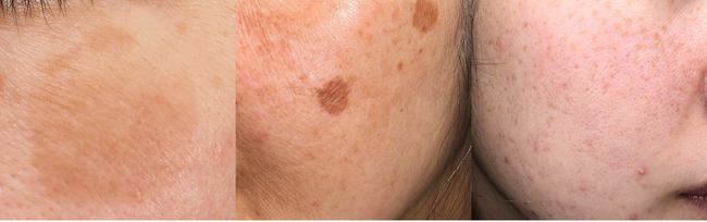 2025年版・年末の“駆け込み美容医療”ランキング調査【施術解説付】