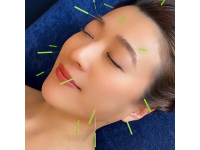 鍼灸業界に革命を！『Re:treat HARi』リトリートハリが叶える“美容鍼灸”