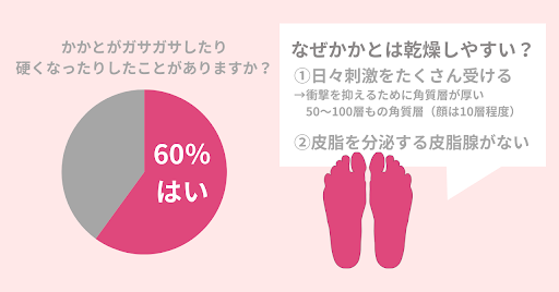 冬の【ガサガサかかと】をどうにかしたい！ツルツルのかかとになるための５つのポイントを紹介