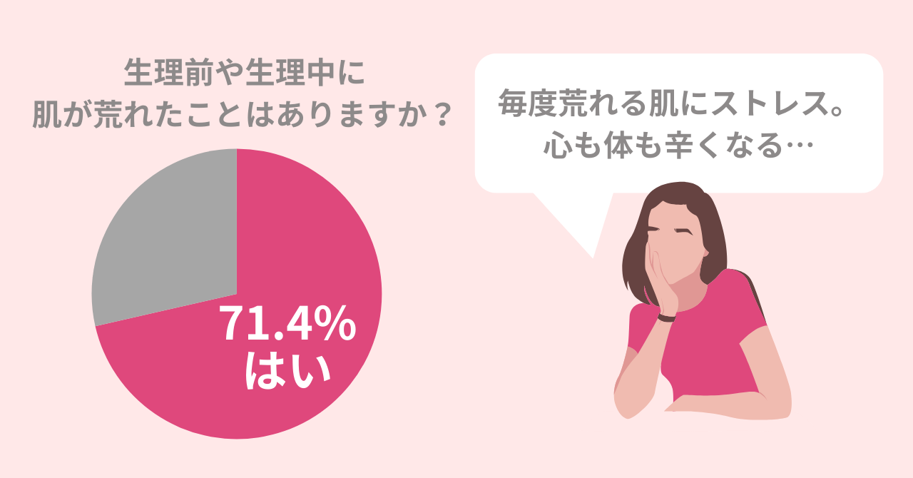 生理前～生理中の肌荒れがストレス。この時期行うべきスキンケアとは?