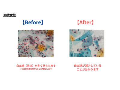 デリケートゾーンソープ、およびオイル使用による膣内フローラ調査結果