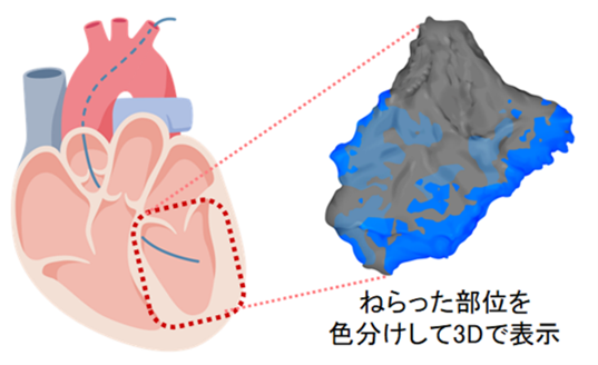 iPS細胞由来心筋球(R)向け投与カテーテルシステムのパートナーに関するお知らせ