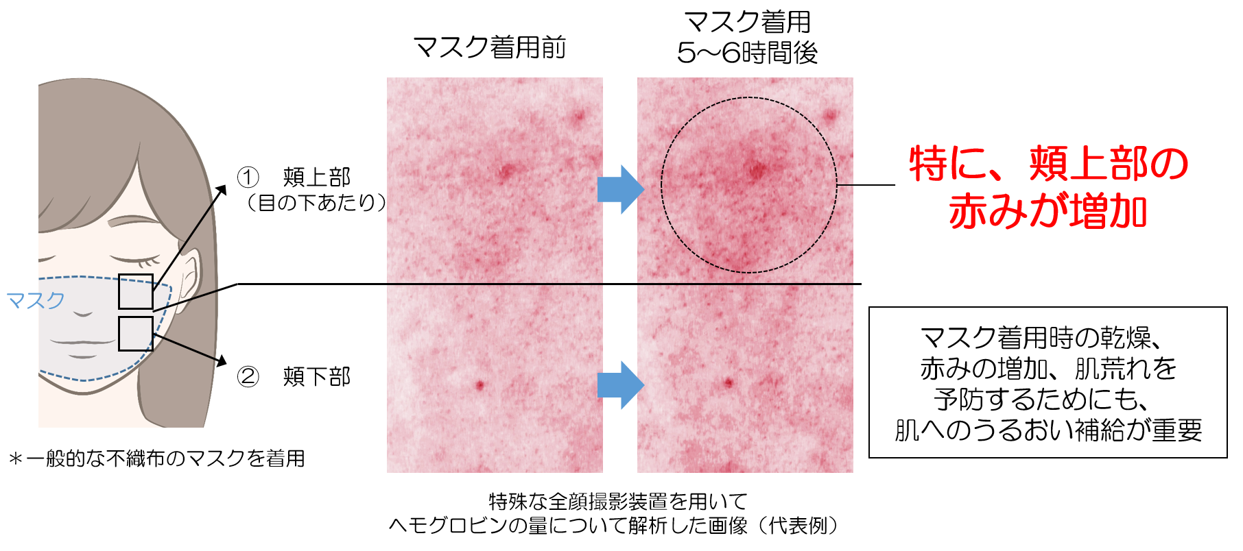 新しい生活様式では 肌へのうるおい補給が重要 最近の肌状態に関するアンケート調査から見えてきた肌荒れリスク 美st Online 美しい40代 50代のための美容情報サイト