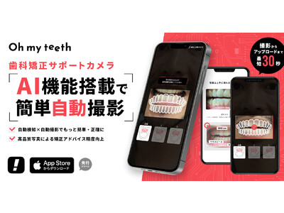 Oh my teethがAI技術を活用した「AI矯正カメラアプリ」をiOS向けに提供開始