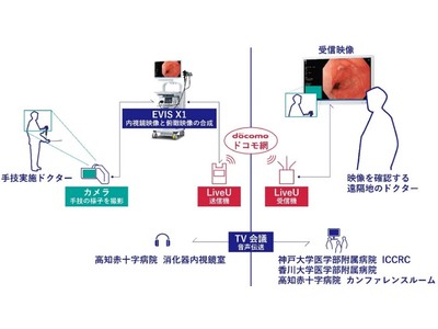 4K映像伝送機材を用いた消化器内視鏡映像のリアルタイム伝送実証に成功