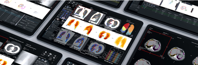 GEwXPAEWp@jwu[NXe[V uXeleris Vv ̔Jn