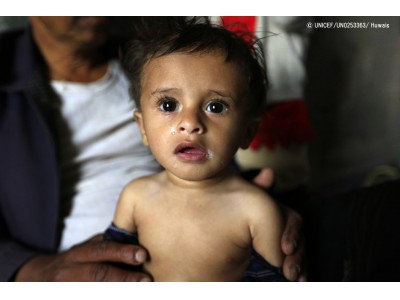 イエメン：急性栄養不良の子ども180万人、高騰した食料に手が届かず【プレスリリース】
