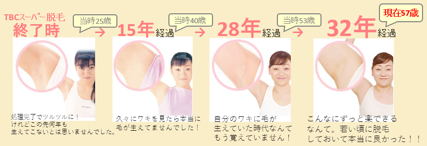 満足度98.8%「TBCスーパー脱毛」はここまでスゴかった！32