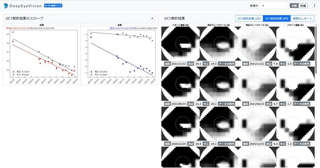 自治医科大学発ベンチャー・DeepEyeVision、緑内障診療等の効…