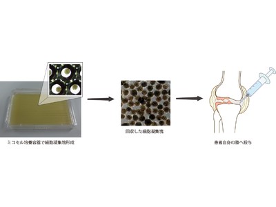 3次元細胞培養容器「ミコセル」を変形性膝関節症に対する臨床研究へ提供開始