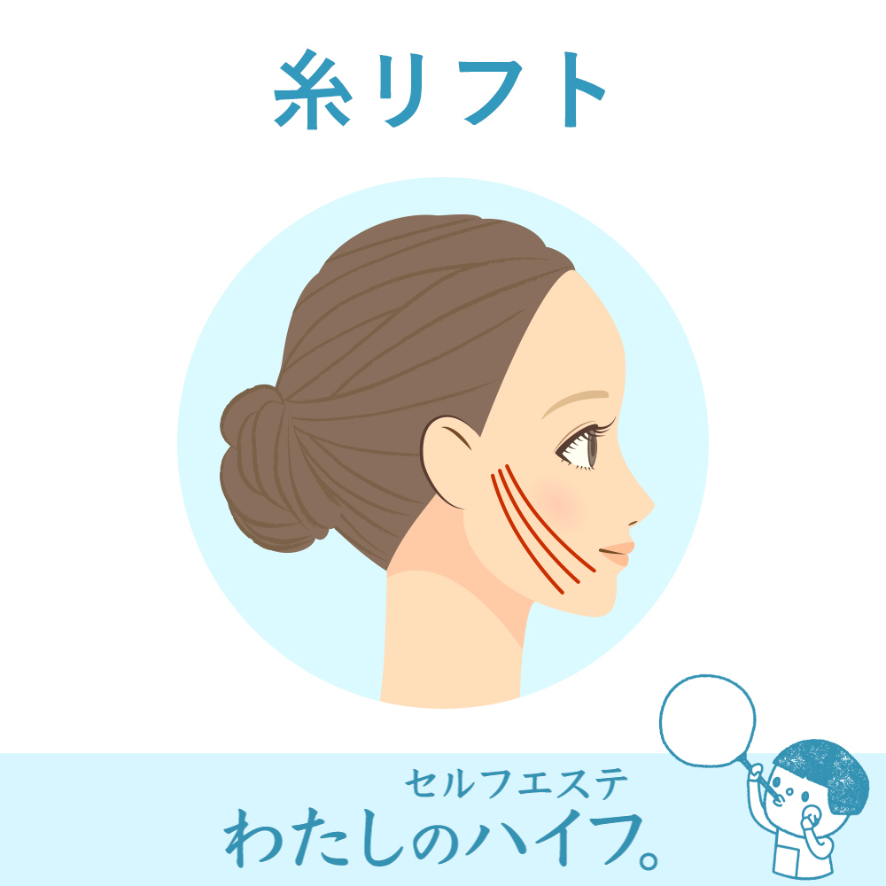セルフエステ「わたしのハイフ」が最先端の切らないフェイス
