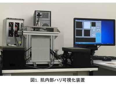 資生堂、肌内部のハリ強度可視化に成功　～　30代からのハリ低下にIII型コラーゲンの減少が関与　～