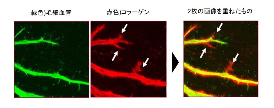 資生堂、肌の弾力と毛細血管の関係性を解明　―　酵母細胞抽出液がコラーゲン産生を助けることを発見　―
