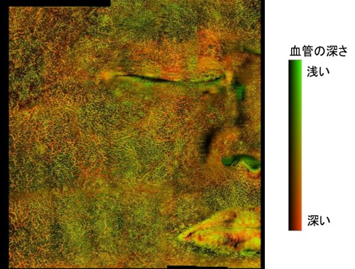 資生堂、顔全体の毛細血管を3次元で可視化することに成功　―健やかで美しい肌の実現に重要な血管の研究は新たなフェーズへ―